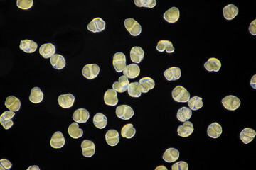 Wall Mural - Microscopic view of Scots pine (Pinus sylvestris) pollen grains. Darkfield illumination.