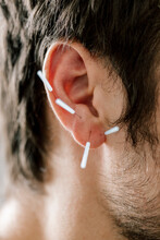 Traditional Chinese Medicine, TCM, Acupuncture, Ear With Acupuncture Needle During Treatment