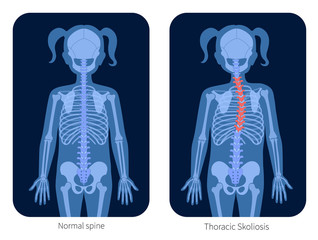 Poster - Spine X ray