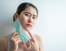Asian Woman Worry About Acne Occur On Her Face After Wearing Mask For Long Time During Covid-19 Pandemic. Wearing Mask For Prolonged Periods Can Damage The Skin.