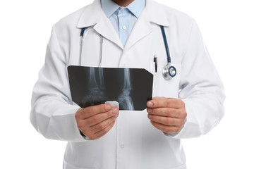 Wall Mural - Orthopedist holding X-ray picture on white background, closeup