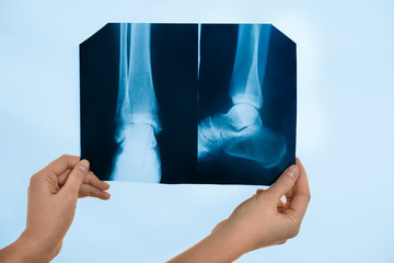 Sticker - Orthopedist examining X-ray picture on viewing screen, closeup