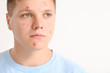 © Pixel-Shot - Teenage boy with acne on light background