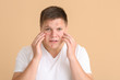 © Pixel-Shot - Teenage boy with acne on color background
