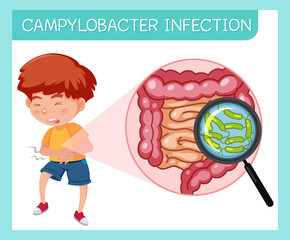 Wall Mural - Boy having campylobacter infection