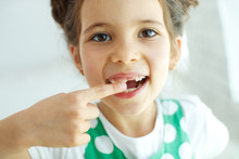 Little Girl With No Tooth. The Child Lost A Tooth. High Quality Photo.
