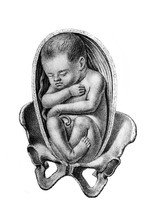 Baby Inside Womb With Legs Down In The Old Book Atlas Abildungen By D. W. Busch, Berlin, 1841