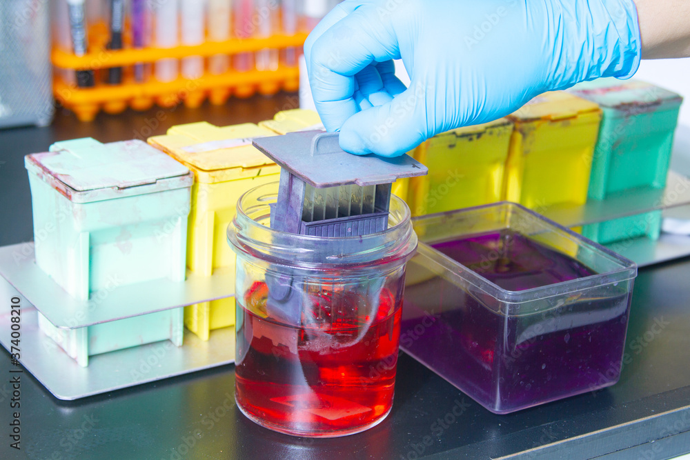 Photo Stock Histology test lab in hospital. Hands in gloves, tech loads ...