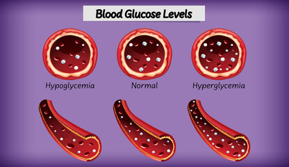 Canvas Print - Medical blood glucose level