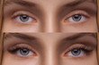 © Aliaksandr Barouski - Eyelash Extension. Comparison of female eyes before and after.
