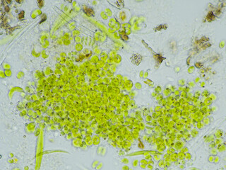  微生物　顕微鏡写真