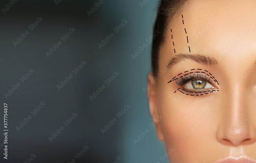 Lower and upper Blepharoplasty.Marking the face.Perforation lines on females face, plastic surgery concept. - obrazy, fototapety, plakaty 