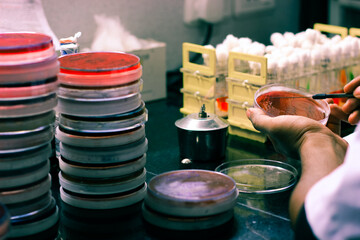 Bacterial Inoculation on a culture plate using inoculation loop by scientist lab technician in microbiology laboratory