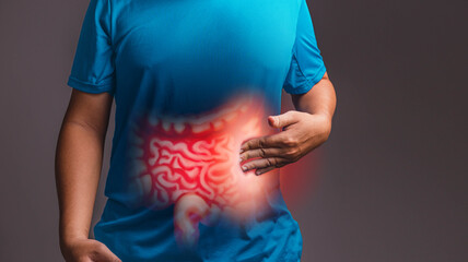 Irritable Bowel Syndrome (IBS)., x-ray concept.