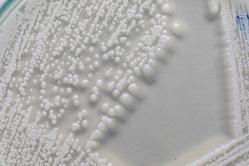 Wall Mural - Yeast in petri dish, Microbiology for education in laboratories.
