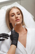 © Denis Vyalov - Enlarging lips, lip correction. Portrait white woman during an operation filling face wrinkles.