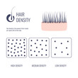 Hair density types classification set. Low, medium, high hair volume on scalp. Anatomical strand structure linear scheme. Outline vector illustration. 