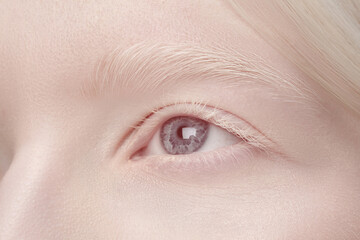 Eye. Close up portrait of beautiful albino woman isolated on white studio background. Beauty, fashion, skincare, cosmetics concept. Copyspace. Well-kept skin, fresh look. Inclusion and diversity.