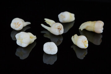 Torn human teeth on a black background. Close-up photo of spoiled molars and premolars. Selective focus.