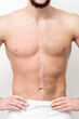 © okskukuruza - Young caucasian man with bare chested before and after waxing his hair stands on white background