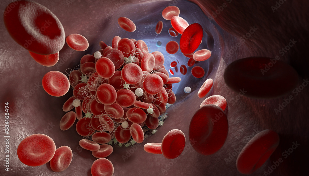 Formation of a blood clot - obrazy, fototapety, plakaty 
