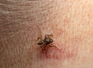 Sticker - Deer fly, Lipoptena cervi biting on human neck, this insect is active during autumn and may bite human in rare occasions