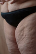 © Danil Nevsky/Stocksy - Crop overweight female with cellulite thighs