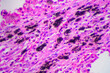 © Pansfun Images/Stocksy - Viral pneumonia disease human cells