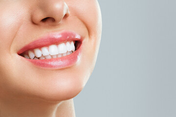 perfect healthy teeth smile of a young woman. teeth whitening. dental clinic patient. stomatology co