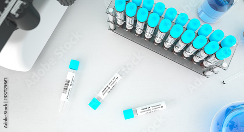 Coronavirus blood testing in a laboratory for Covid-19 top view. Covid medical screening. Blood samples in glass test tubes flat lay.