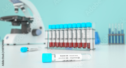 Covid-19  blood testing in a lab for coronavirus . Covid medical screening Coronavirus. Blood samples in glass test tubes.