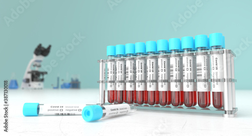 Coronavirus blood testing in a laboratory for Covid-19 . Covid medical screening. Blood samples in glass test tubes.