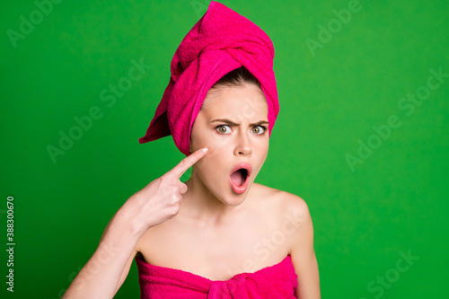 Close-up portrait of attractive worried mad lady wearing towel turban touching cheek pimple isolated on bright green color background
