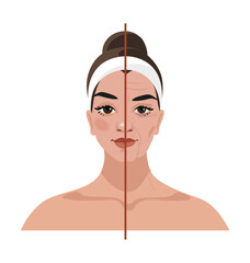 Portrait of a young woman and age-related changes on her face. Before and after cosmetic procedures, injections, plastic surgery. Flat vector illustration.