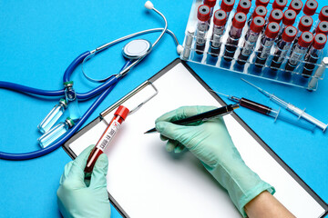 lab technician assistant or doctor holding a blood sample in test tube