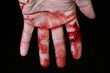 Close up hand injury, Finger cut with knife, real bloody hand