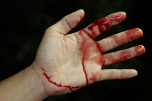 Close Up Hand Injury, Finger Cut With Knife, Real Bloody Hand