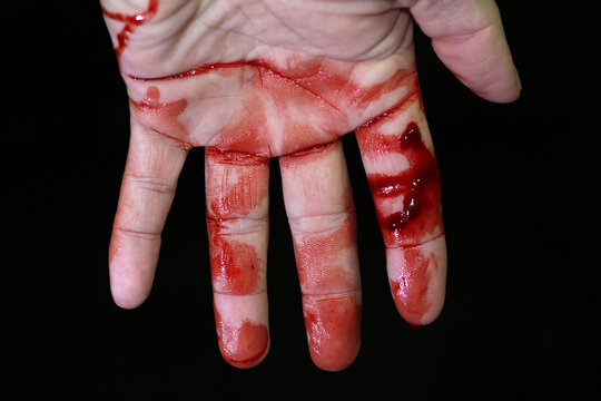 close up hand injury, finger cut with knife, real bloody hand