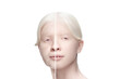 © master1305 - Comparison. Portrait of beautiful albino woman with problem and clean skin, aging and youth concept, beauty treatment and lifting. Before and after. Youth, old age. Process of aging and rejuvenation