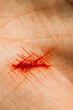 © Marko/Stocksy - Fresh bloody cut on human hand