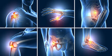 Painful Joints. Shoulder Joint, Knee Joint, Wrist Joint, Hip Joint, Ankle Joint, Vertebral Joint. Medical 3D Illustration