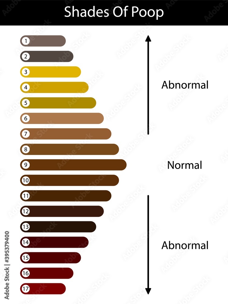 Shades color of poop. Human feces color. Healthy concept. Normal and ...