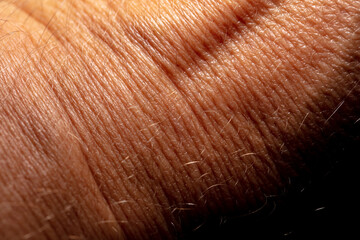 Wall Mural - Close up of human skin as an abstract background.