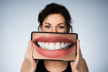 Fund Woman Portrait With Dental Braces