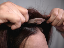 Applying A Hair Topper On Top Of A Woman's Natural Hair And Scalp. Covering Hair Thinning On The Crown Or The Front Area Of Head Or Adding Volume. The Front Wig Clip Is Visible.