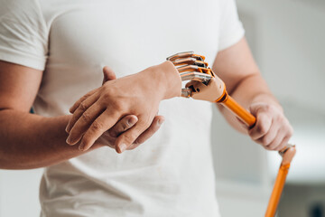 Medical technician in a white t-shirt holding prosthetic arm