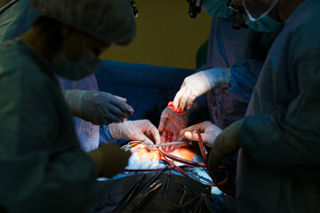 Wall Mural - Surgeons in the operating room do operation