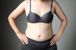 © 1827photography - fat woman cellulite belly unhealthy