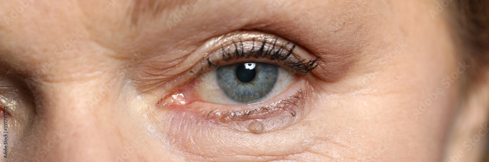 Close-up of attractive womans eye. Macro shot of senior female looking in camera. Beautiful blue colour eyeball and appearance. Wrinkles and moles. Youth and ageing. Natural beauty concept - obrazy, fototapety, plakaty 