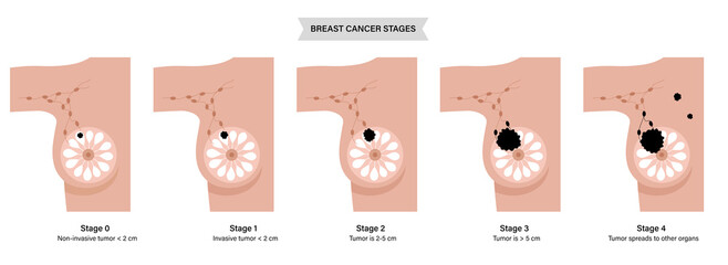 Sticker - Breast disease concept